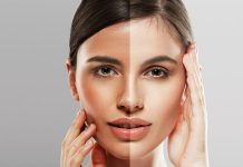 How to Whiten Skin Naturally